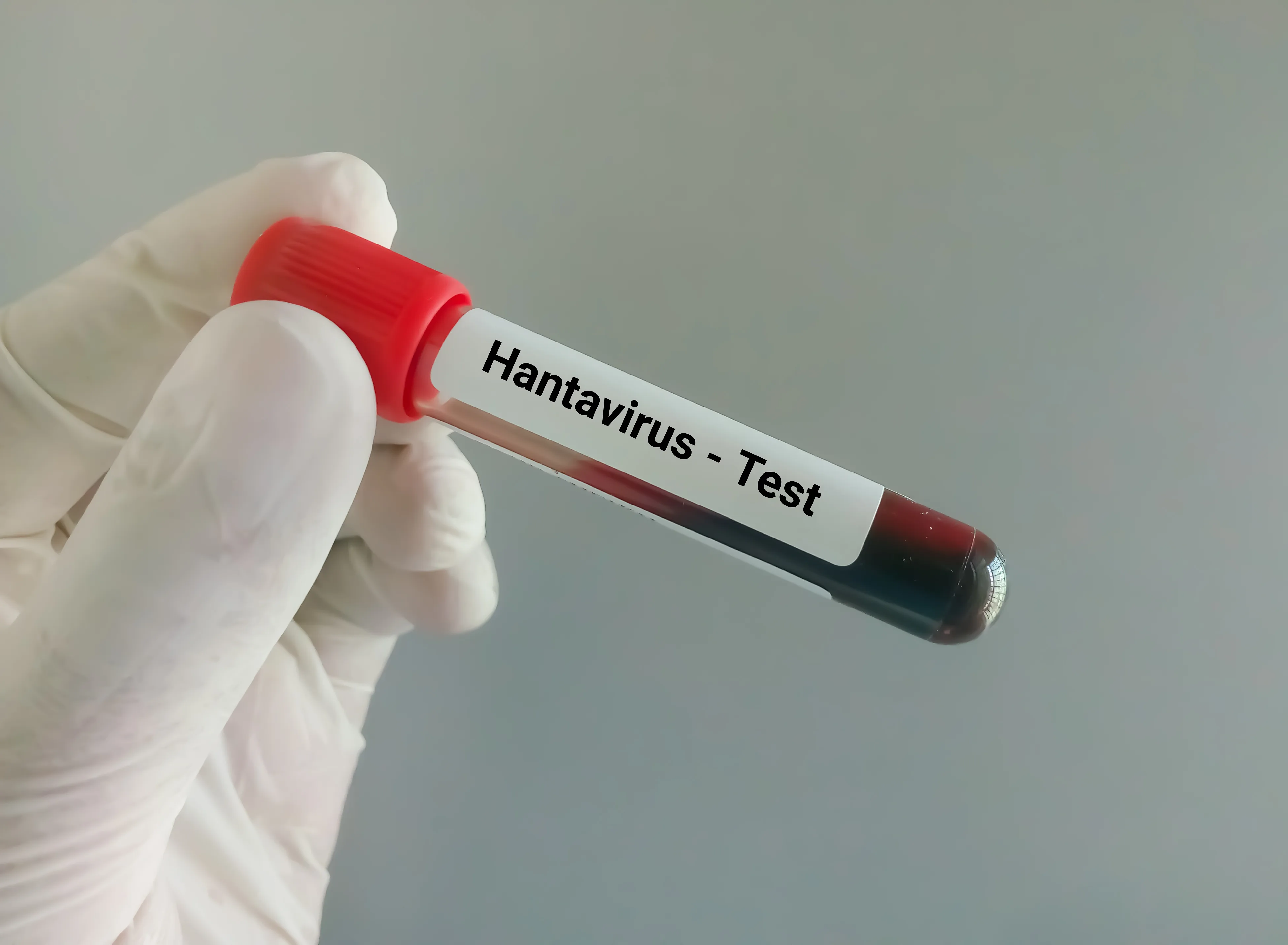 Pompier din Caraș-Severin internat cu suspiciune de hantavirus