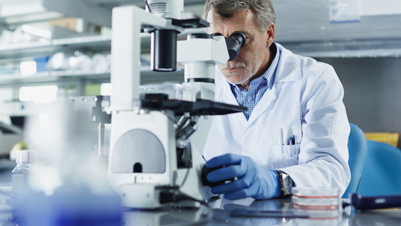 Cromozomul Y dispare treptat din celulele bărbaților odată cu vârsta